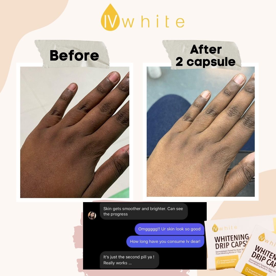 IVWHITE Whitening Capsule (New Formula)