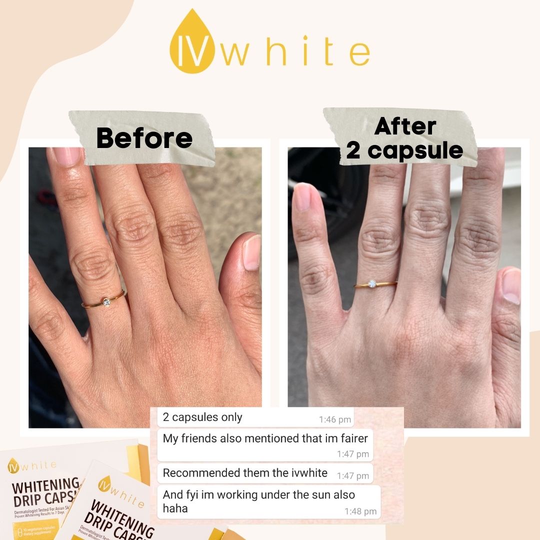 IVWHITE Whitening Capsule (New Formula)