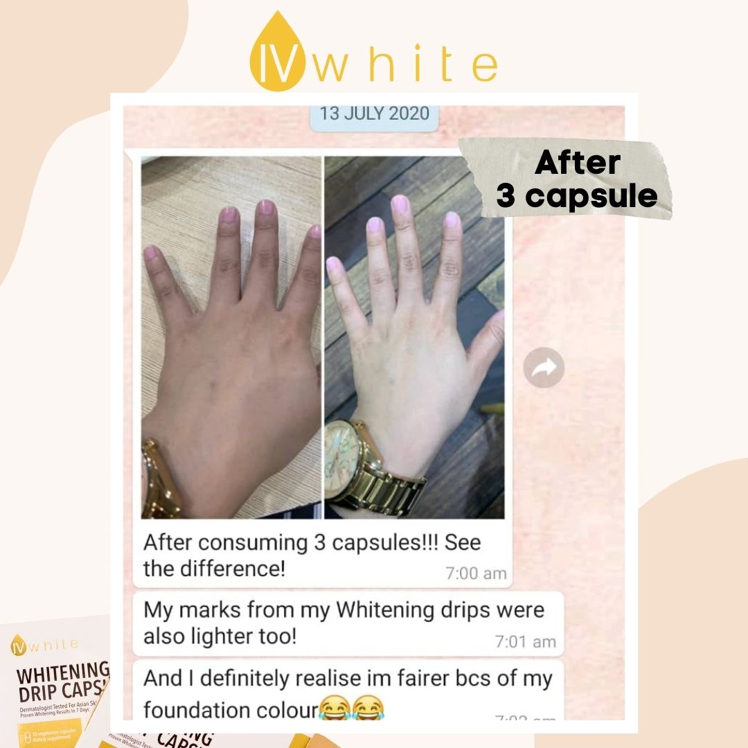 IVWHITE Whitening Capsule (New Formula)