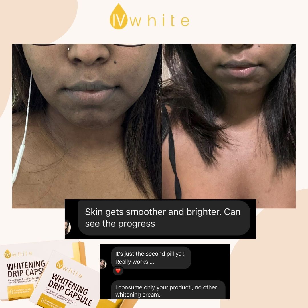 IVWHITE Whitening Capsule (New Formula)